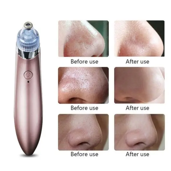 Вакуумен уред за почистване на лице - skin care