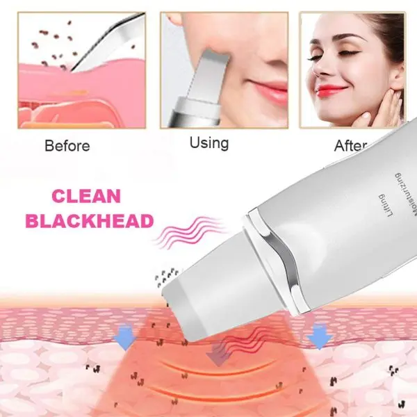 Ултразвукова шпатула за лице - LMC Beauty » Murzel.bg Ha84ed036acb14a57bba488112110480dR