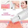Ултразвукова шпатула за лице - LMC Beauty » Murzel.bg Ултразвукова шпатула за лице LMC Beauty » 37.90 лв