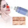 Вакуумен уред за черни точки - Pore device » Murzel.bg Вакуумен уред за черни точки - Pore device