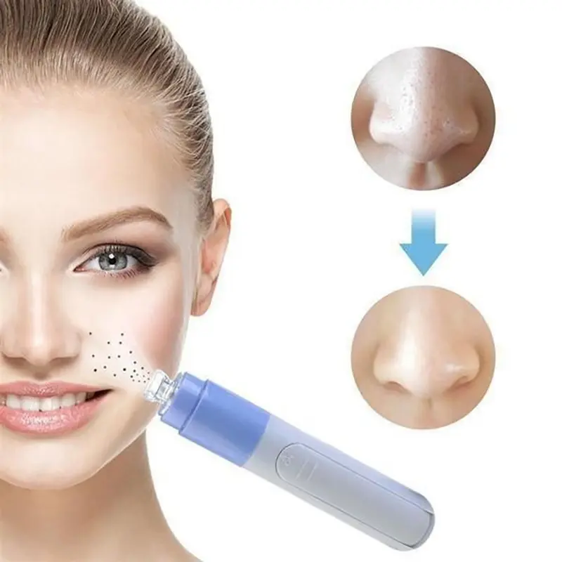 Вакуумен уред за черни точки - Pore device » Murzel.bg Вакуумен уред за черни точки - Pore device